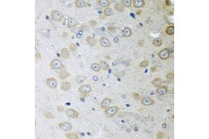 Immunohistochemistry of paraffin-embedded mouse brain using ATAD3A antibody at dilution of 1:100 (40x lens).