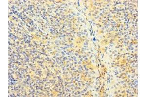 Immunohistochemistry of paraffin-embedded human tonsil tissue using ABIN7170373 at dilution of 1:100 (SNX22 Antikörper  (AA 1-120))