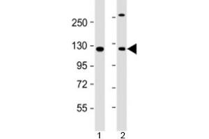 Western blot testing of human 1) A431 and 2) HeLa cell lysate with INTS6 antibody at 1:2000.