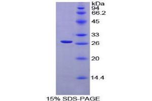 SDS-PAGE analysis of Rat XRCC6 Protein. (XRCC6 Protein)
