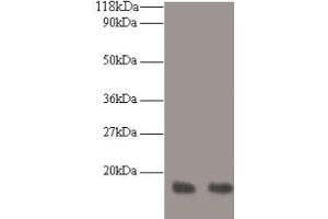 Western blot All lanes: RPA3 antibody at 2 μg/mL Lane 1: LO2 whole cell lysate Lane 2: HepG2 whole cell lysate Secondary Goat polyclonal to rabbit IgG at 1/10000 dilution Predicted band size: 14 kDa Observed band size: 14 kDa (RPA3 Antikörper  (AA 1-119))