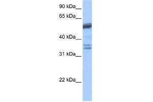 WB Suggested Anti-COIL Antibody Titration: 0. (Coilin Antikörper  (C-Term))