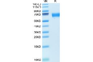 Human AMIGO2 on Tris-Bis PAGE under reduced condition. (AMIGO2 Protein (AA 40-398) (His tag))