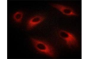 ABIN6267613 staining C6 cells treated with λ phosphatase by ICC/IF. (PKC zeta Antikörper  (pThr410))
