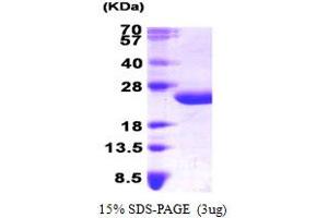 SDS-PAGE (SDS) image for Interleukin 6 (IL6) (AA 30-212) protein (His tag) (ABIN666780)