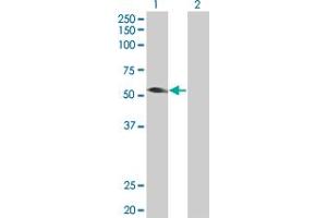 Western Blot analysis of TRIM31 expression in transfected 293T cell line by TRIM31 MaxPab polyclonal antibody. (TRIM31 Antikörper  (AA 1-425))