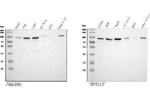 Western blot analysis of STIM1 using anti-STIM1 antibody (ABIN3043940), Left) and anti-STIM1 antibody (ABIN7606404), Right). (STIM1 Antikörper  (N-Term))