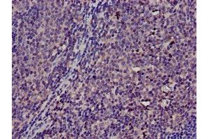 Immunohistochemistry of paraffin-embedded human lymph node tissue using ABIN7172131 at dilution of 1:100 (TMSB4X Antikörper  (AA 6-44))