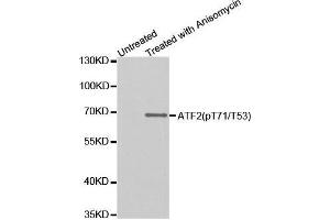 Western blot analysis of extracts from HUVEC cells untreated or treated with Anisomycin, using Phospho-ATF2-T53 antibody.