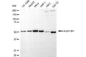 Western blotting analysis using ALDH1B1 antibody (ABIN7797559). (ALDH1B1 Antikörper)