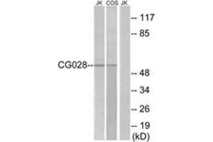 Western Blotting (WB) image for anti-CCZ1 Homolog, Vacuolar Protein Trafficking and Biogenesis Associated (CCZ1) (AA 411-460) antibody (ABIN2890813) (CCZ1 / CGI-43 Antikörper  (AA 411-460))