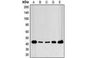 Western blot analysis of FOP expression in MCF7 (A), MDAMB231 (B), MDAMB435 (C), mouse brain (D), rat brain (E) whole cell lysates. (FGFR1OP Antikörper  (C-Term))
