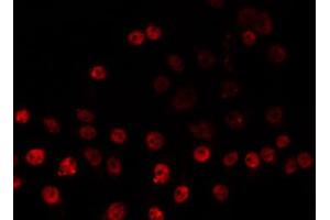 ABIN6266831 staining HeLa by IF/ICC. (ZNF225 Antikörper  (C-Term))