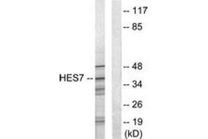 Western blot analysis of extracts from NIH-3T3 cells, using HEXIM1 Antibody. (HEXIM1 Antikörper  (AA 181-230))