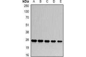 Western blot analysis of PSMA6 expression in HepG2 (A), Hela (B), mouse skeletal muscle (C), PC12 (D), COS7 (E) whole cell lysates. (PSMA6 Antikörper)