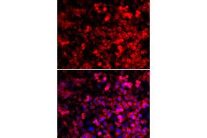 Immunofluorescence analysis of U2OS cells using QARS antibody. (QARS Antikörper)