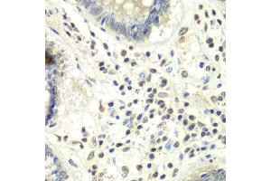 Immunohistochemistry of paraffin-embedded human colon using PRMT5 antibody. (PRMT5 Antikörper)