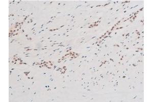 Immunohistochemistry (IHC) image for anti-Spleen tyrosine Kinase (SYK) (pTyr348) antibody (ABIN6255895)