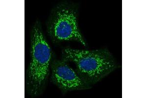 Immunofluorescence analysis of HeLa cells using TWF1 antibody (green). (TWF1 Antikörper  (AA 335-384))
