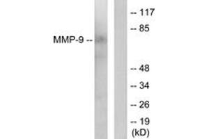 Western blot analysis of extracts from HepG2 cells, using MMP-9 Antibody. (MMP 9 Antikörper  (AA 651-700))