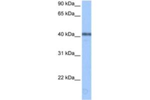 Western Blotting (WB) image for anti-Apolipoprotein B mRNA Editing Enzyme, Catalytic Polypeptide-Like 3F (APOBEC3F) antibody (ABIN2462071)
