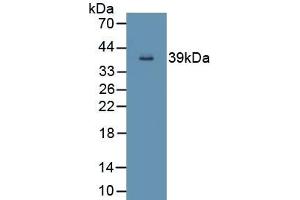 Detection of Recombinant ND5, Human using Polyclonal Antibody to NADH Dehydrogenase 5 (ND5) (MT-ND5 Antikörper  (AA 522-603))