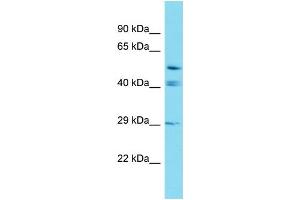 Western Blotting (WB) image for anti-Glutaredoxin, Cysteine Rich 2 (GRXCR2) (C-Term) antibody (ABIN2438093) (GRXCR2 Antikörper  (C-Term))
