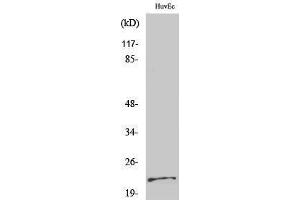 Western Blotting (WB) image for anti-Parkinson Protein 7 (PARK7) (Internal Region) antibody (ABIN3176773) (PARK7/DJ1 Antikörper  (Internal Region))