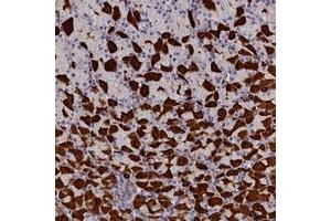 Immunohistochemical staining of human stomach with RTTN polyclonal antibody  shows strong cytoplasmic positivity in gastric parietal cells at 1:200-1:500 dilution. (Rotatin (RTTN) Antikörper)