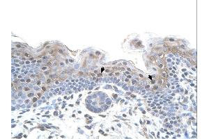 STRAP antibody was used for immunohistochemistry at a concentration of 4-8 ug/ml. (STRAP Antikörper  (C-Term))