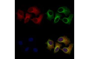 ABIN7094743 and ABIN7098794 staining Hela cells by IF/ICC.