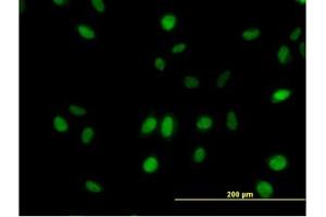 Image no. 3 for anti-Mediator Complex Subunit 21 (MED21) (AA 1-145) antibody (ABIN599079) (MED21 Antikörper  (AA 1-145))
