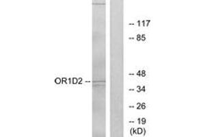 Western blot analysis of extracts from Jurkat cells, using OR1D2 Antibody. (OR1D2 Antikörper  (AA 201-250))