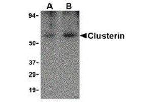 Western Blotting (WB) image for anti-Clusterin (CLU) antibody (ABIN2473012)