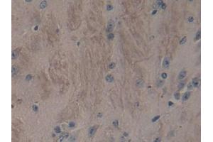 Immunohistochemistry (IHC) image for anti-ADAM Metallopeptidase with Thrombospondin Type 1 Motif, 2 (Adamts2) (AA 855-1030) antibody (ABIN7440095)
