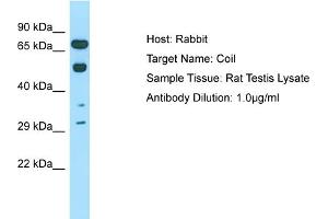 Host: Rabbit Target Name: COIL Sample Tissue: Rat Testis Antibody Dilution: 1ug/ml (Coilin Antikörper  (C-Term))