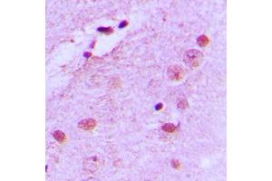 Immunohistochemical analysis of Nucleophosmin (pT199) staining in human brain formalin fixed paraffin embedded tissue section. (NPM1 Antikörper  (pSer199))