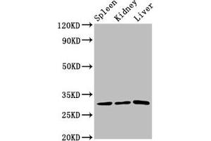 Western Blot Positive WB detected in: Rat spleen tissue, Rat kidney tissue, Rat liver tissue All lanes: CD27 antibody at 3. (CD27 Antikörper  (AA 20-191))