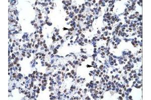 Image no. 1 for anti-Glial Cells Missing Homolog 1 (GCM1) (N-Term) antibody (ABIN6735857) (GCM1 Antikörper  (N-Term))