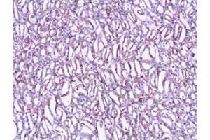 Immunohistochemical staining of formalin-fixed paraffin-embedded human kidney tissue showing nuclear and cytoplasmic staining with CLIC1 polyclonal antibody  at 1 : 100 dilution. (CLIC1 Antikörper  (N-Term))
