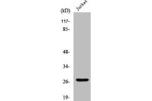Western Blot analysis of Jurkat cells using Cleaved-Cathepsin C HC (R394) Polyclonal Antibody (CTSC Antikörper  (Cleaved-Arg394))