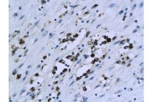 Formalin-fixed and paraffin embedded human endometrial tissue labeled with Anti-XIAP/BIRC4 Polyclonal Antibody, Unconjugated (ABIN674364) followed by conjugation to the secondary antibody and DAB staining