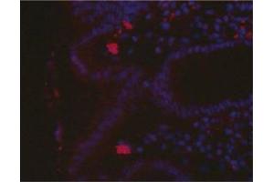 Immunofluorescence imageof H. (Helicobacter Pylori Antikörper)