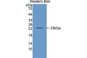 Western Blotting (WB) image for anti-Linker For Activation of T Cells Family, Member 2 (LAT2) (AA 29-193) antibody (ABIN5013879)