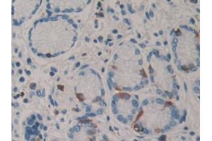 DAB staining on IHC-P; Samples: Human Stomach Tissue (PARN Antikörper  (AA 178-245))