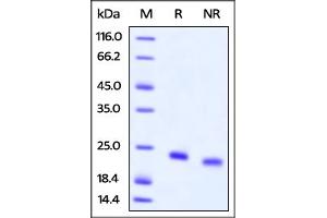 Biotinylated Human IL-4, Avitag,His Tag on  under reducing (R) and ing (NR) conditions. (IL-4 Protein (AA 25-153) (His tag,AVI tag,Biotin))