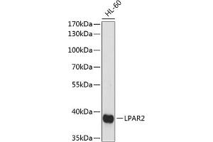 Western blot analysis of extracts of HL-60 cells, using LP antibody (ABIN7268335) at 1:1000 dilution.