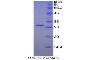 SDS-PAGE (SDS) image for Leukocyte Immunoglobulin-Like Receptor B3 (LILRB3) (AA 410-631) protein (His tag) (ABIN1879153)