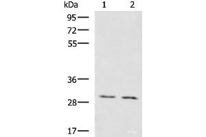 Western blot analysis of Mouse brain tissue Mouse kidney tissue lysates using KRCC1 Polyclonal Antibody at dilution of 1:1350 (KRCC1 Antikörper)