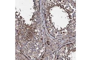 Immunohistochemical staining of human testis with BRWD2 polyclonal antibody  shows strong cytoplasmic positivity in cells in seminiferous ducts.